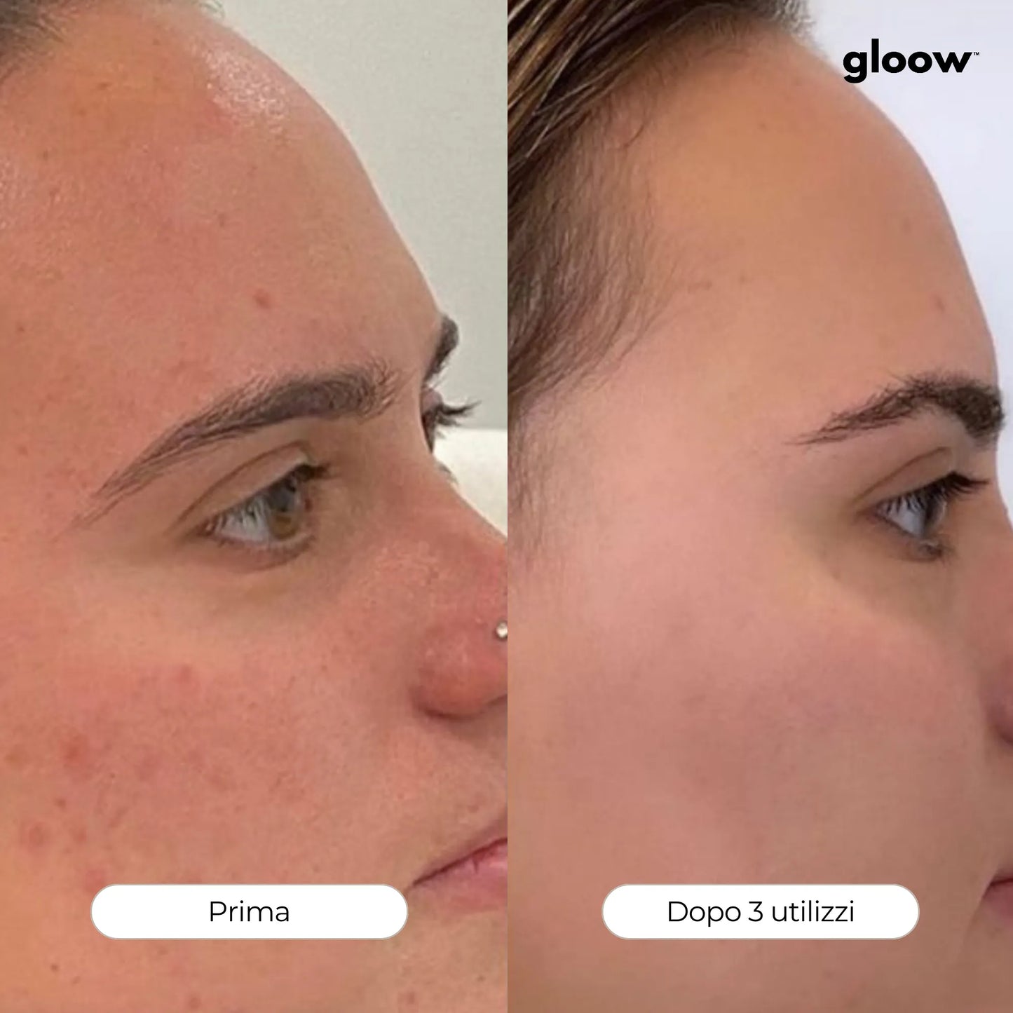 Gloow Micro-Infusione Anti-Rughe | Peptidi + Collagene