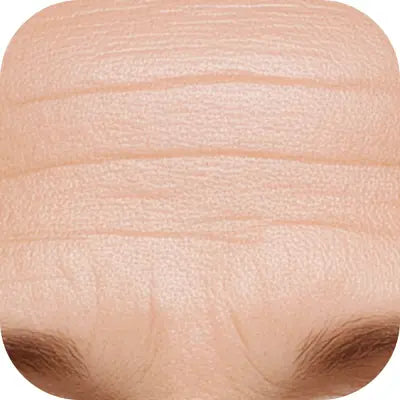 feature-item-1