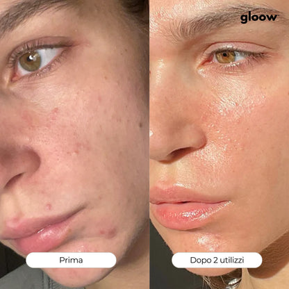 Gloow Micro-Infusione Anti-Rughe | Peptidi + Collagene