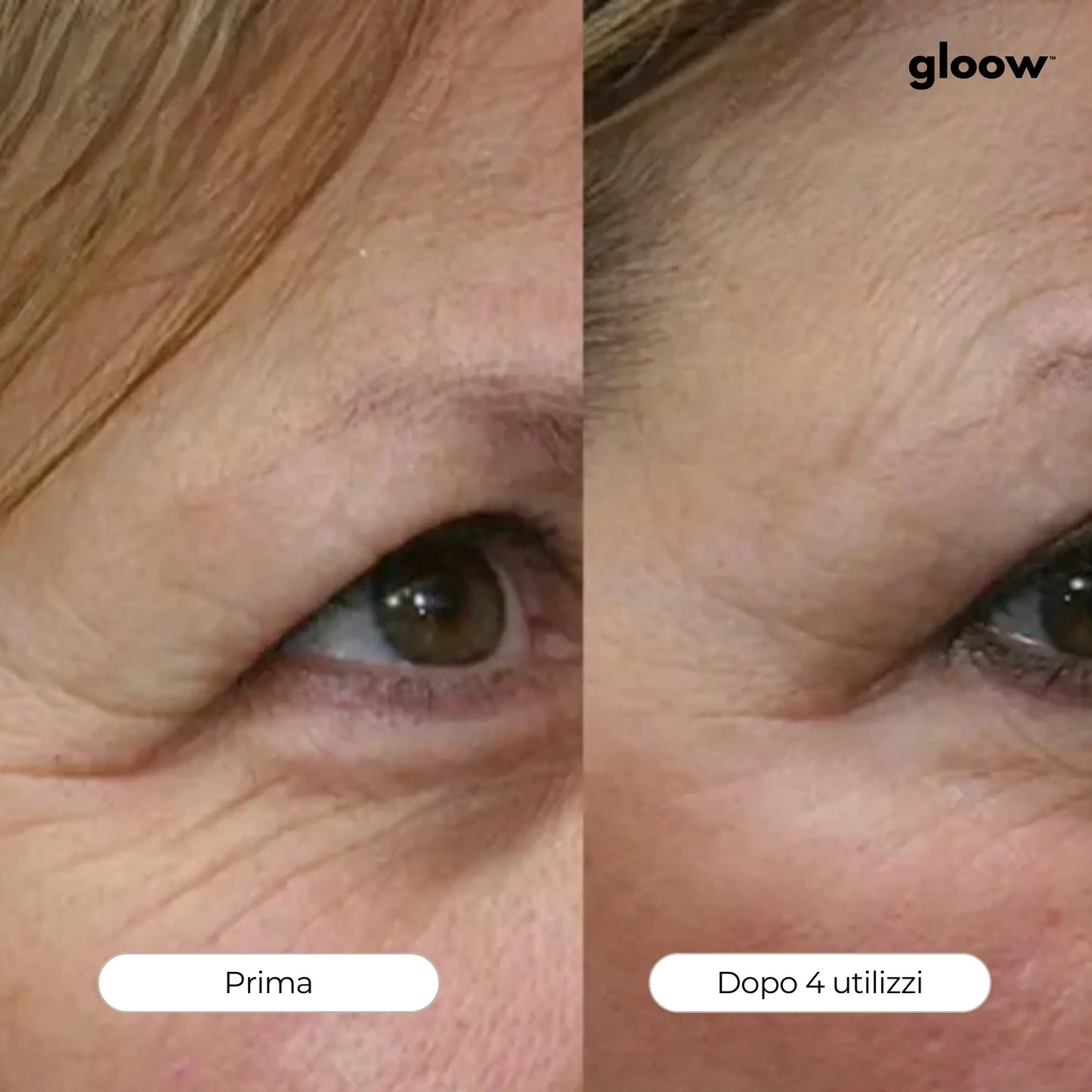 Gloow Micro-Infusione Anti-Rughe | Peptidi + Collagene