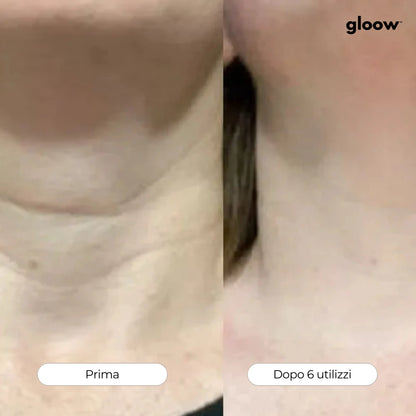 Gloow Micro-Infusione Anti-Rughe | Peptidi + Collagene