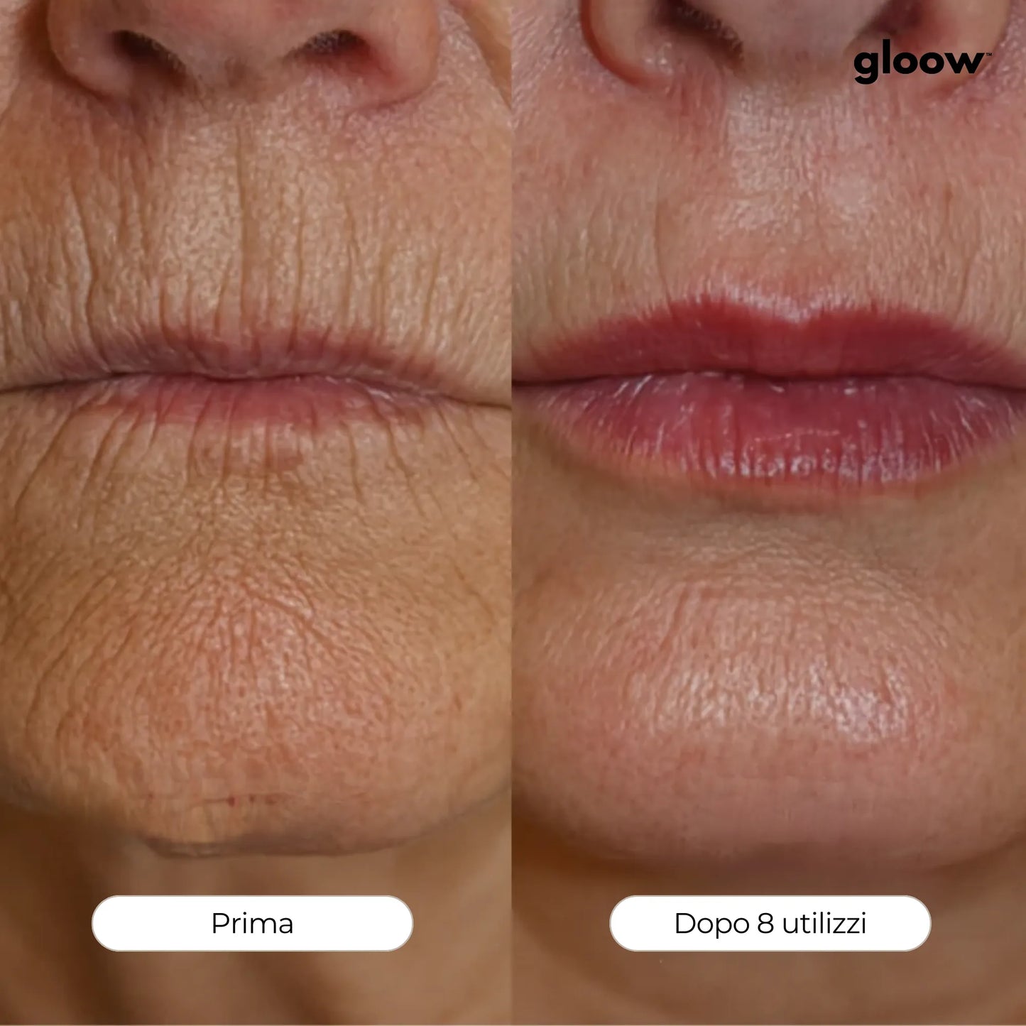 Gloow Micro-Infusione Anti-Rughe | Peptidi + Collagene