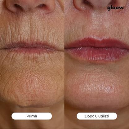 Gloow Micro-Infusione Anti-Rughe | Peptidi + Collagene