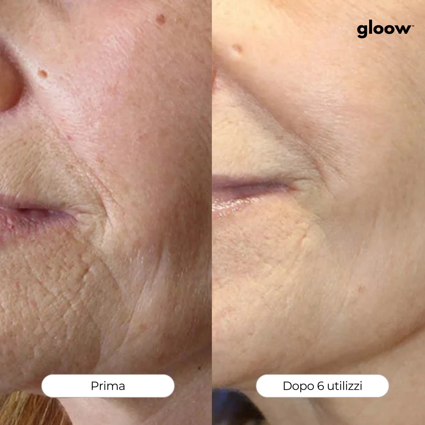 Gloow Micro-Infusione Anti-Rughe | Peptidi + Collagene